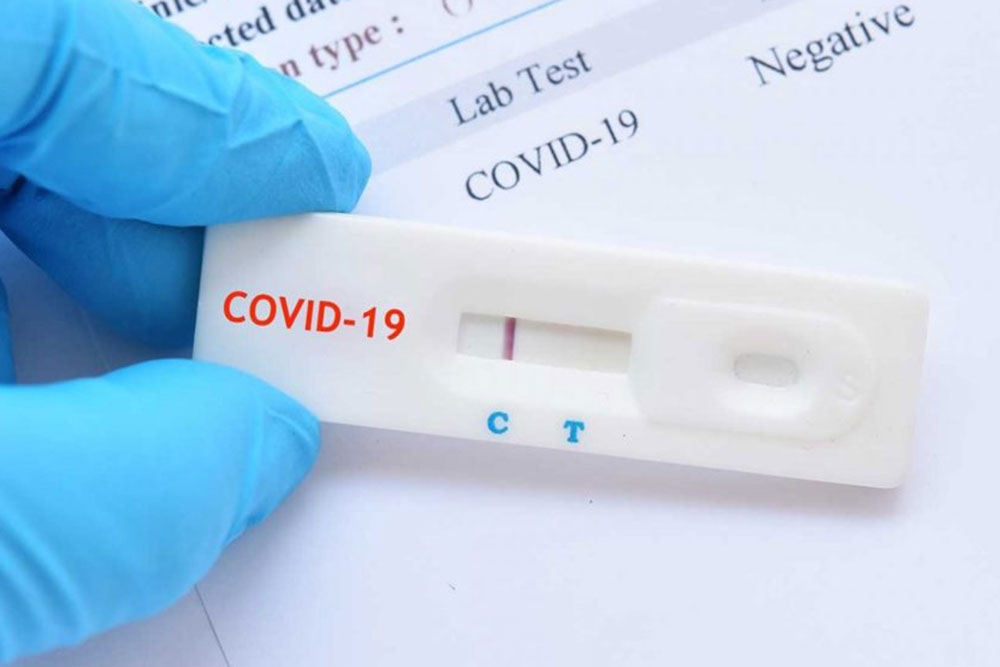 Novi rekord; U županiji 385 novih slučajeva zaraze, 48 iz Župe dubrovačke, preminule dvije starije osobe