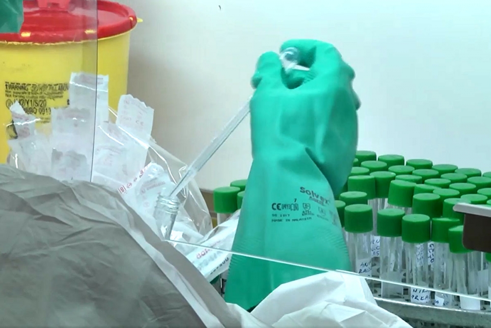 U županiji 33 nova slučaja zaraze, čak devet iz Župe dubrovačke, četiri pacijenta na respiratoru