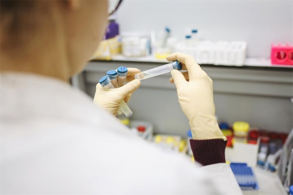 U posljednja 24 sata od 5930 testiranja 516 novih slučajeva zaraze, na respiratoru 101 pacijent, preminulo 18 osoba